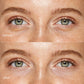 Pink Eye Patches for Puffy Eyes